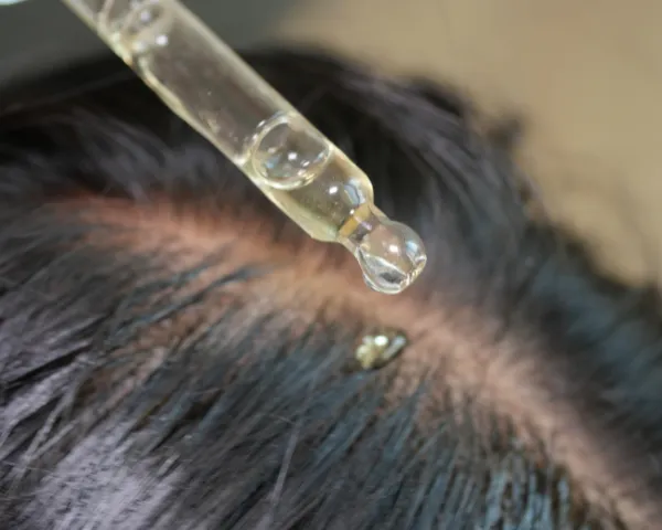 Hair Scalp Treatment in Perungudi at Tula Unisex Salon and Spa